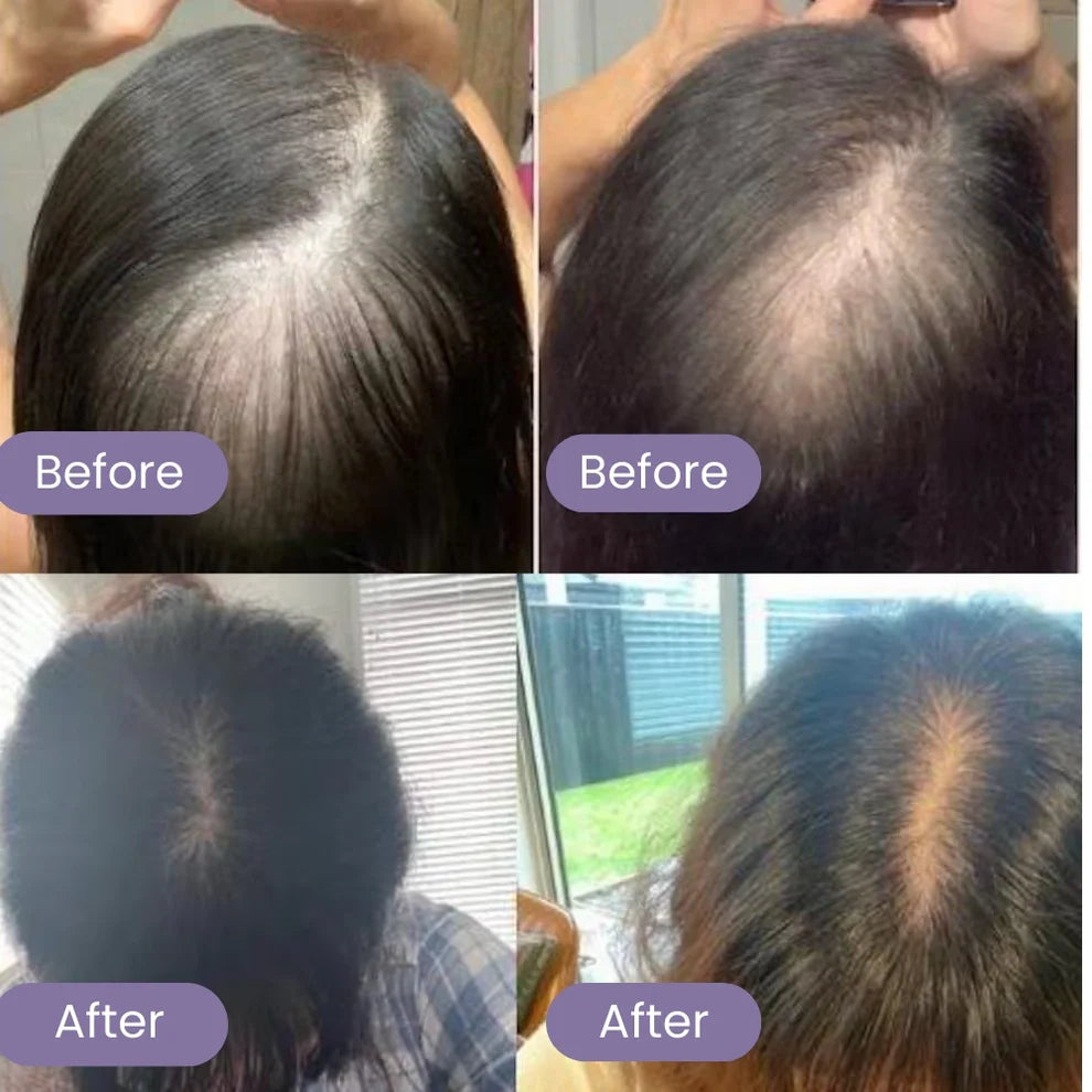 Natural Hair Growth Serum