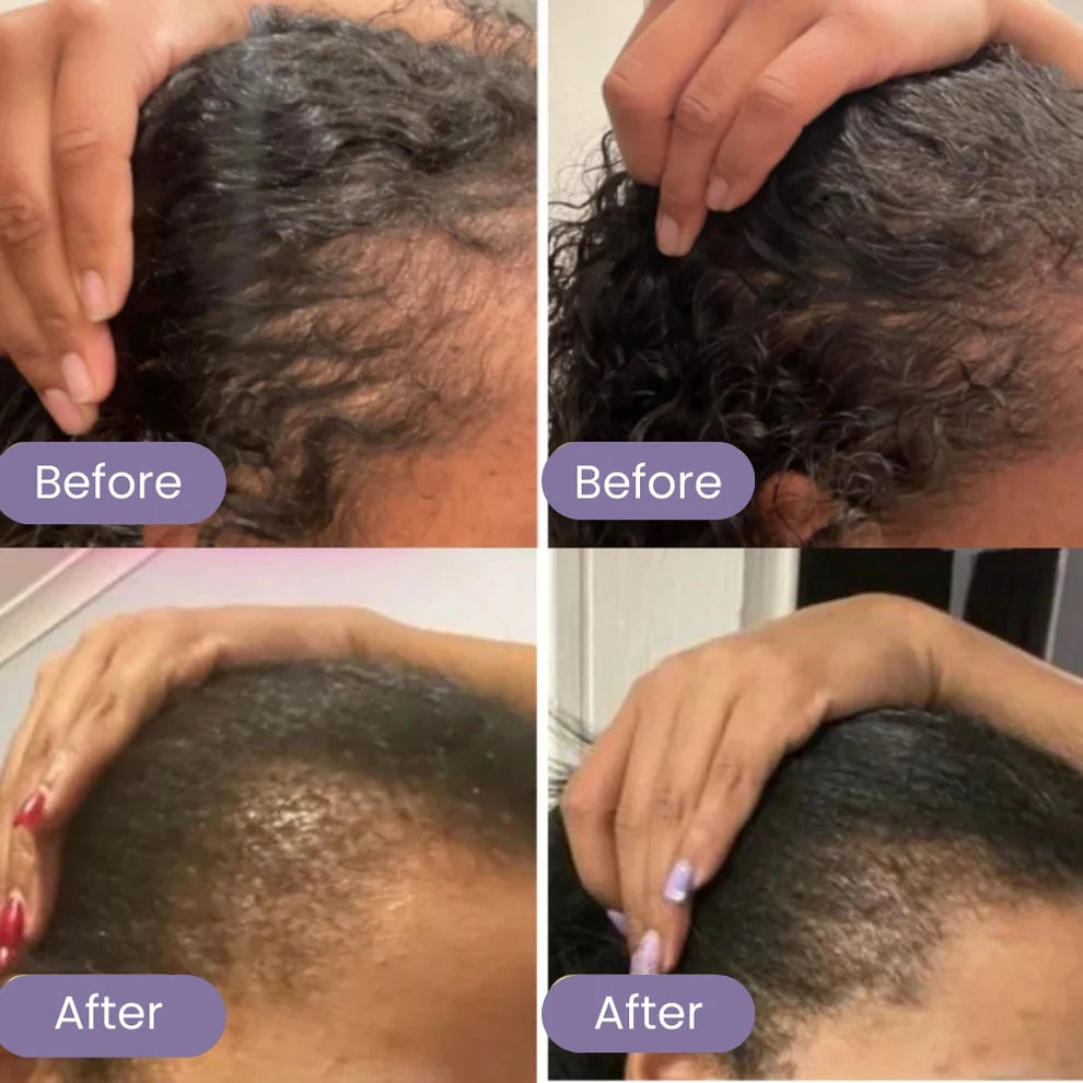 Natural Hair Growth Serum