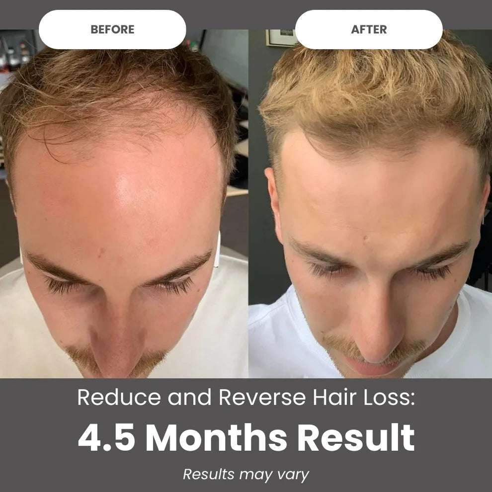 All-in-One Liquid Batana Oil