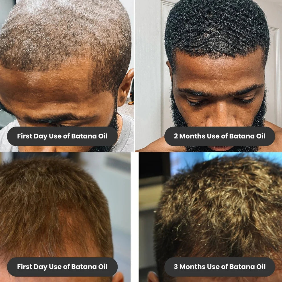 All-in-One Liquid Batana Oil